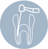 Endodoncia
